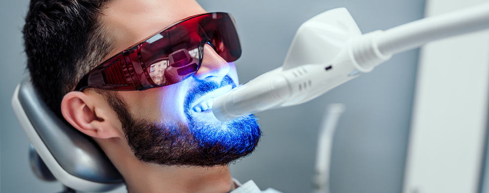 Man getting his teeth whitened at the dentist's office.